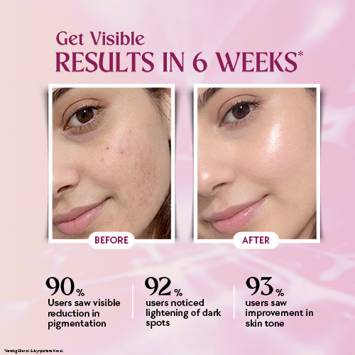 Get Visible Results in 6 Weeks