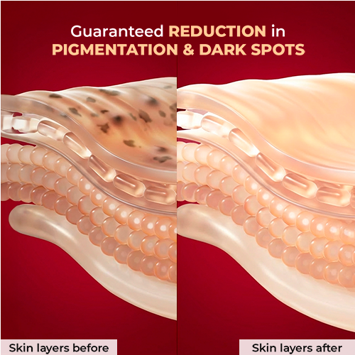 Guaranteed REDUCTION in PIGMENTATION & DARK SPOTS