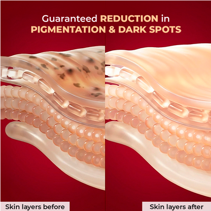 Guaranteed REDUCTION in PIGMENTATION & DARK SPOTS