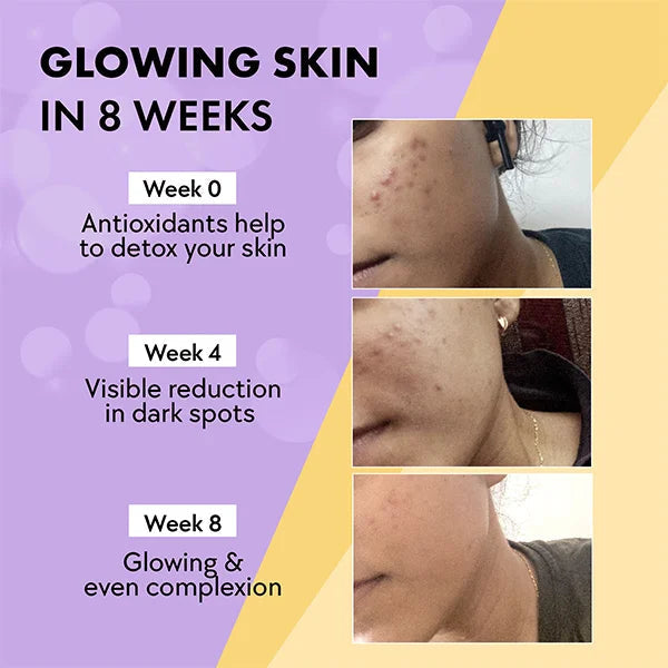 Glow – Glutathione Tablets for Skin Glow & Even-Toned Skin - Blackcurrent